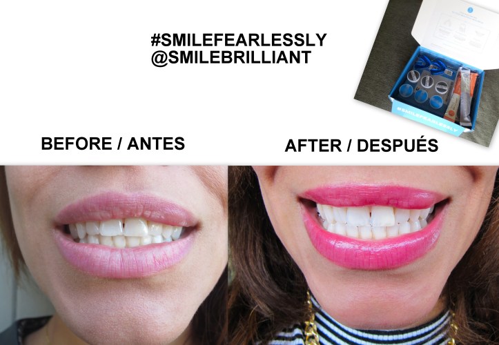 PROMOTIONS SMILE BRILLIANT-TEETH WHITENING-BLANQUEAMIENTO DENTAL